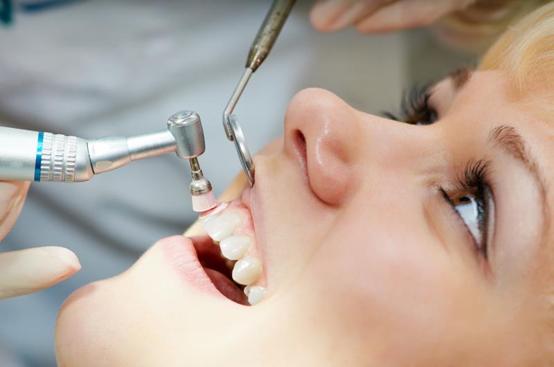 Dental Cleanings & Preventive Care in Hayward, CA