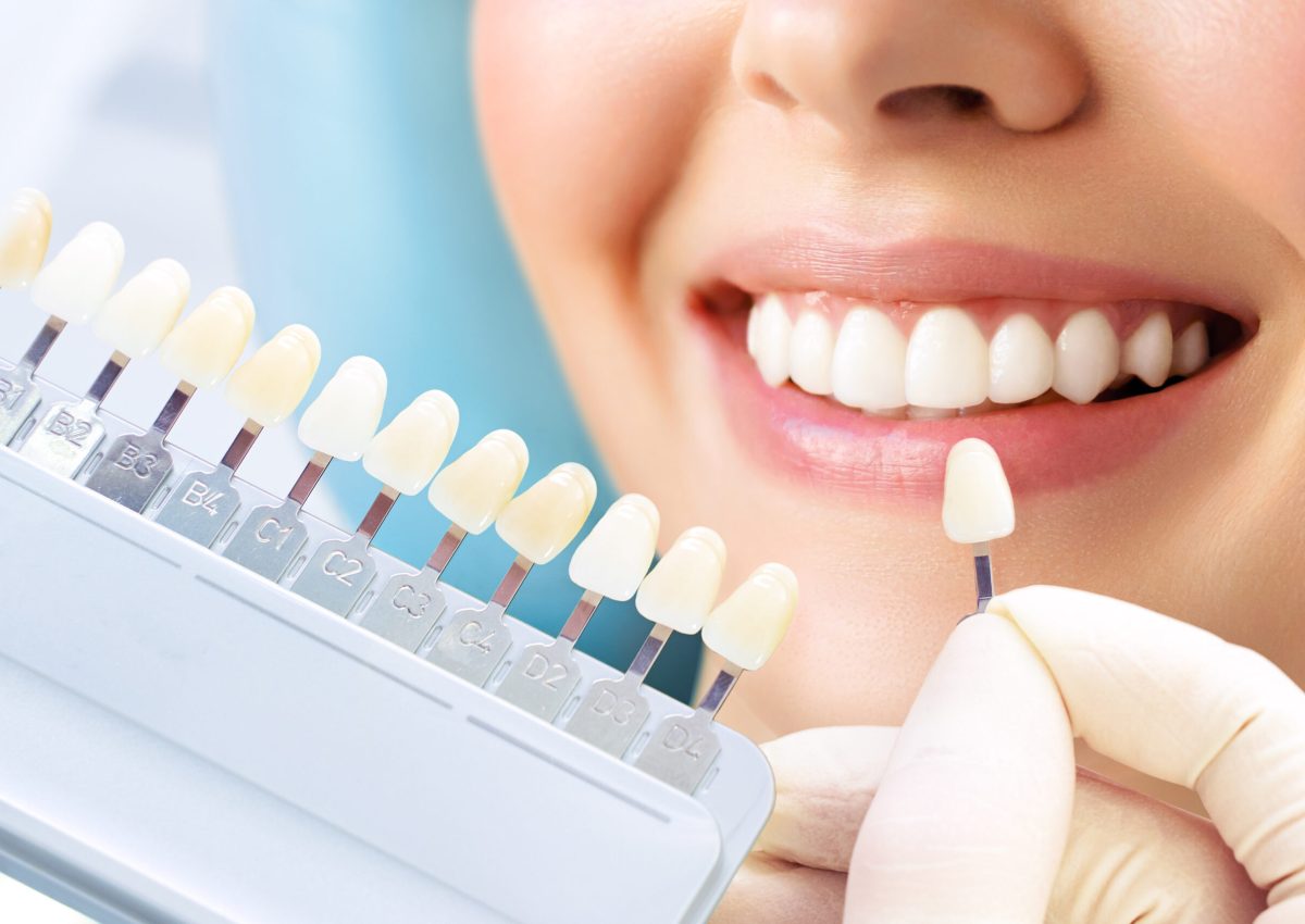 Smiling young woman. Cosmetological teeth whitening in a dental clinic. selection of the tone of the implant tooth.