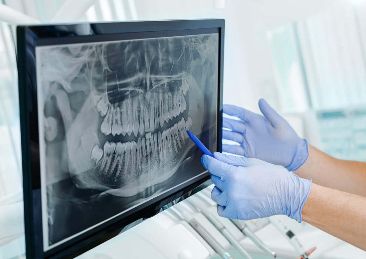 Hands doctor dentist in gloves show the teeth on x-ray on digital screen in dental clinic on light background with medical equipment. Smile healthy teeth concept, close up